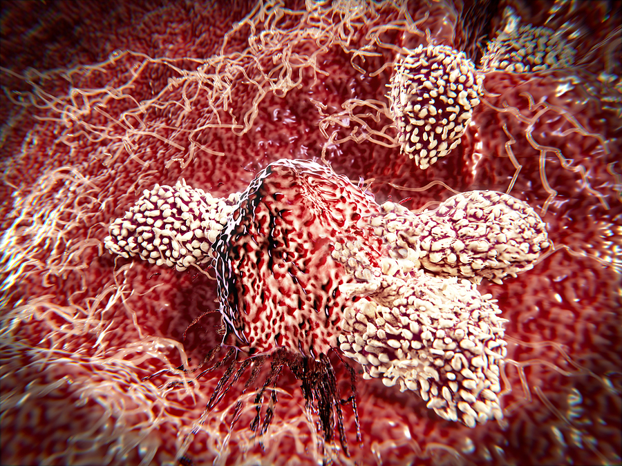 Cancer Immunotherapy and T-cells